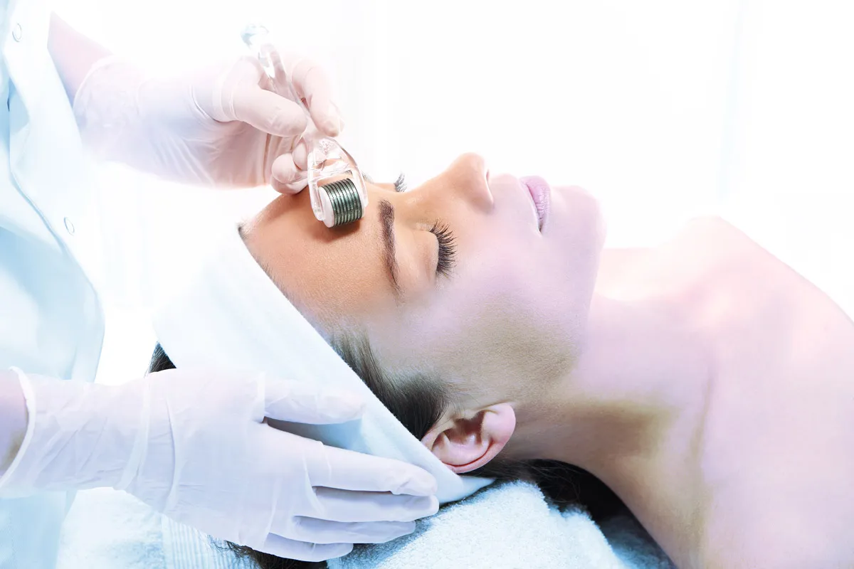 Mirconeedling im Gesicht einer Frau